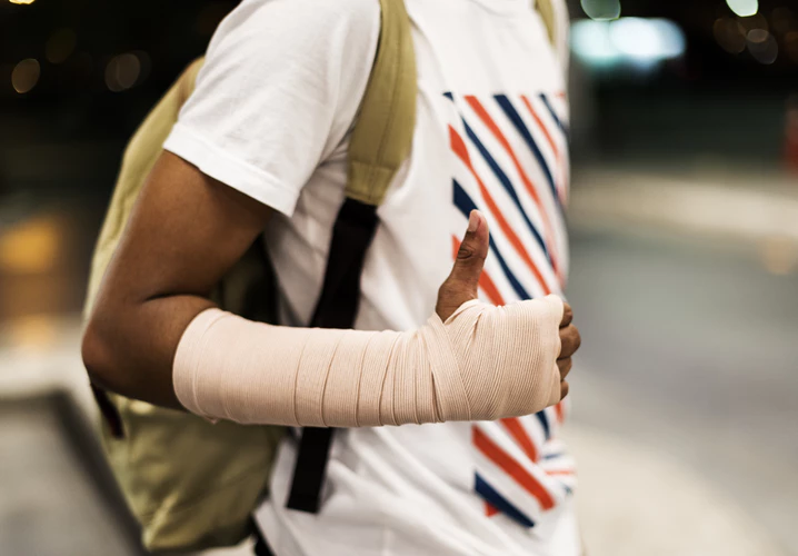 sprained-arm